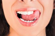 piercing-ortodonzia